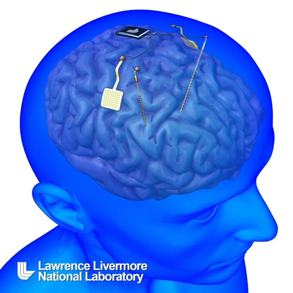 Neural Implants
