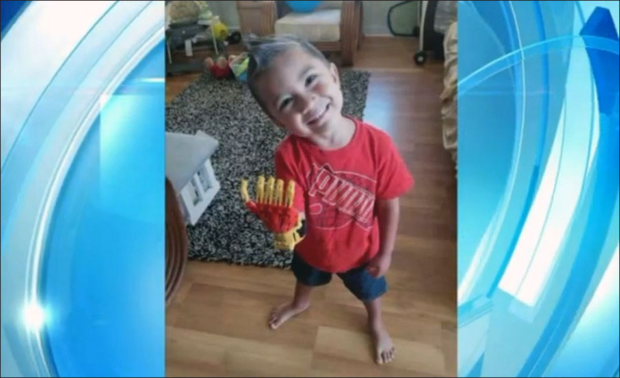 Three-Year-Old Boy Gets a 3D-Printed Prosthetic Iron Man Hand