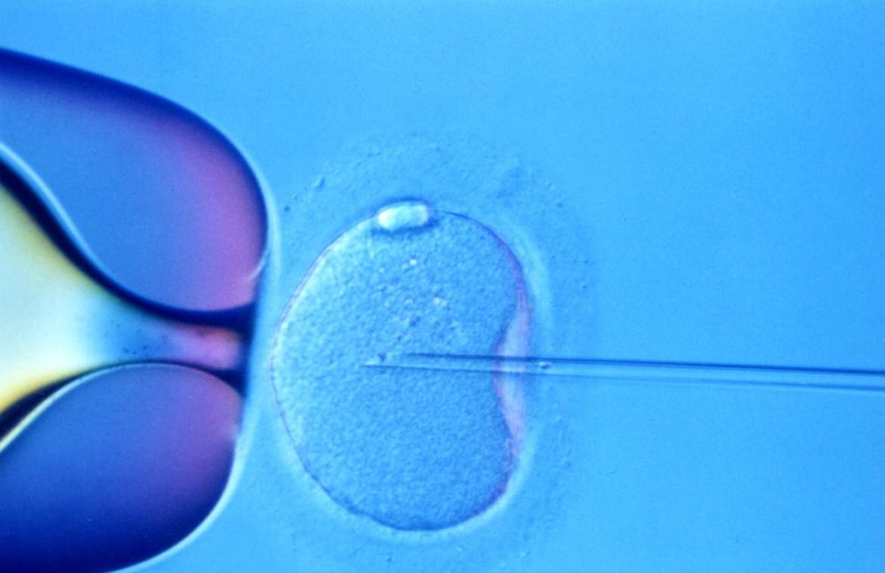 New Test Indentifies Best Embroyos, Increasing Likelihood of Successful In Vitro Fertilzation