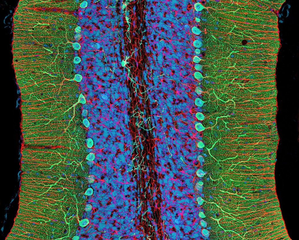New Invention Reveals Cells, Signaling Pathways in Living Brains