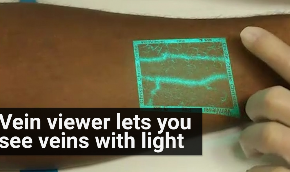 VeinViewer Means No More Poking People Relentlessly to Locate Veins