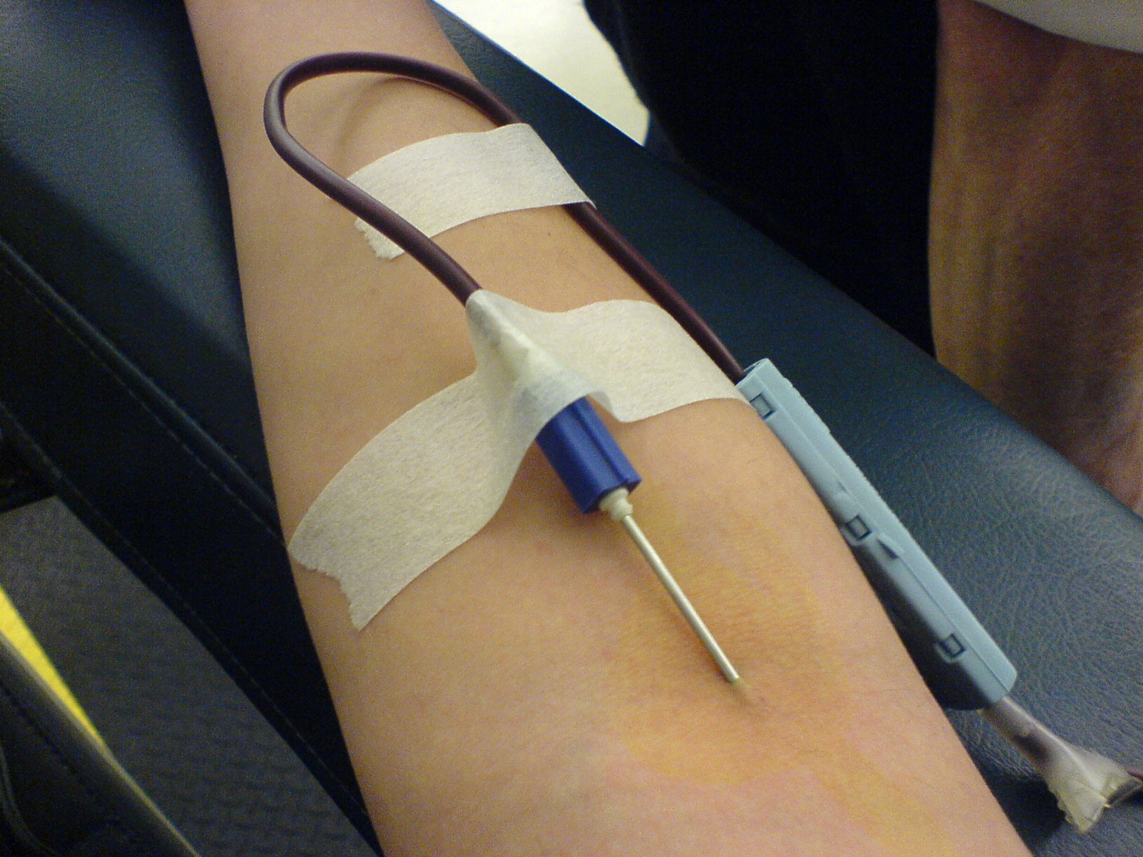 Swedish Blood Donors Get a Text Message When Their Blood Saves a Life