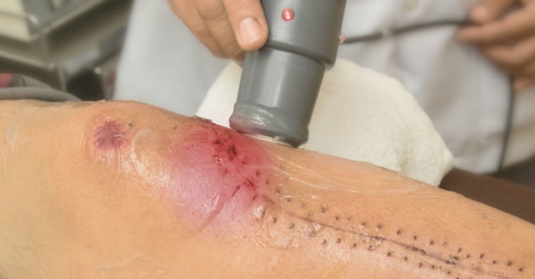 Heal Wounds Faster With Low-Intensity Ultrasound Technology