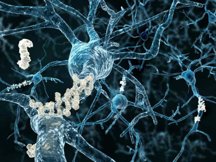 Chemical Washes Away Alzheimer’s Protein and Restores Memory in Mice