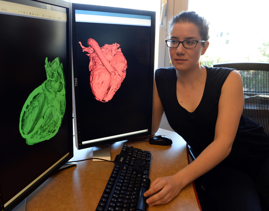 Turning MRI Scans Into Accurate 3D Printed Models in Hours
