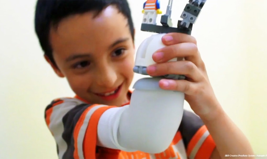 This Lego Arm Lets Kids Customize Their Own Prosthetics