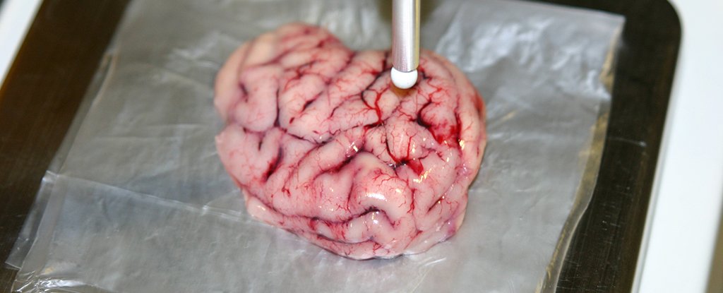 Smart Scalpel Can Detect Cancerous Tumors, Making Risky Brain Surgery Safer