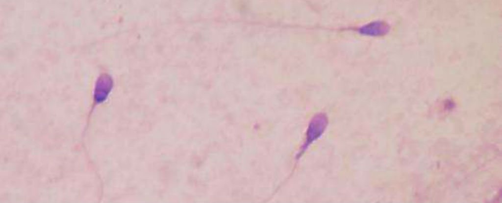 Scientists Grow Sperm From Skin Cells
