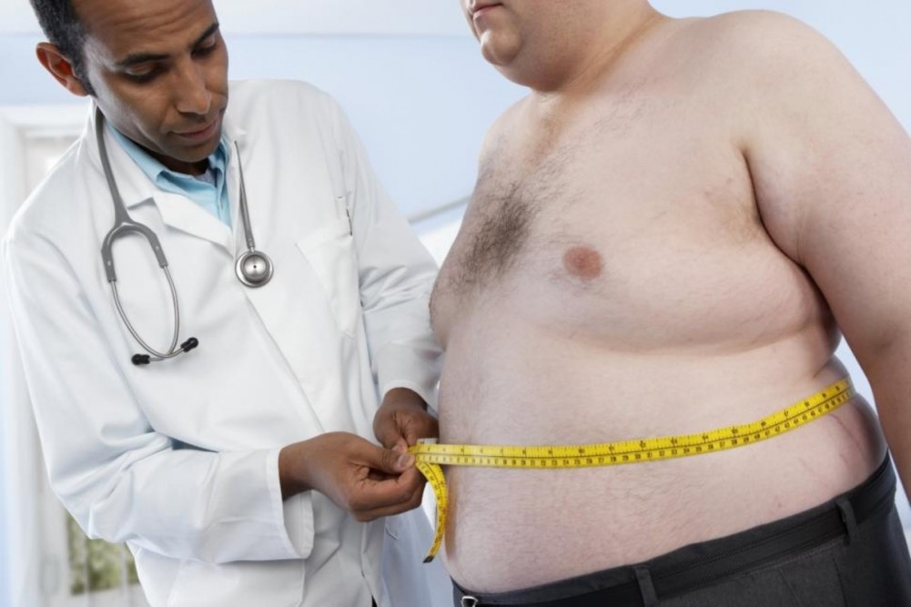 Obesity & Metabolic Switch