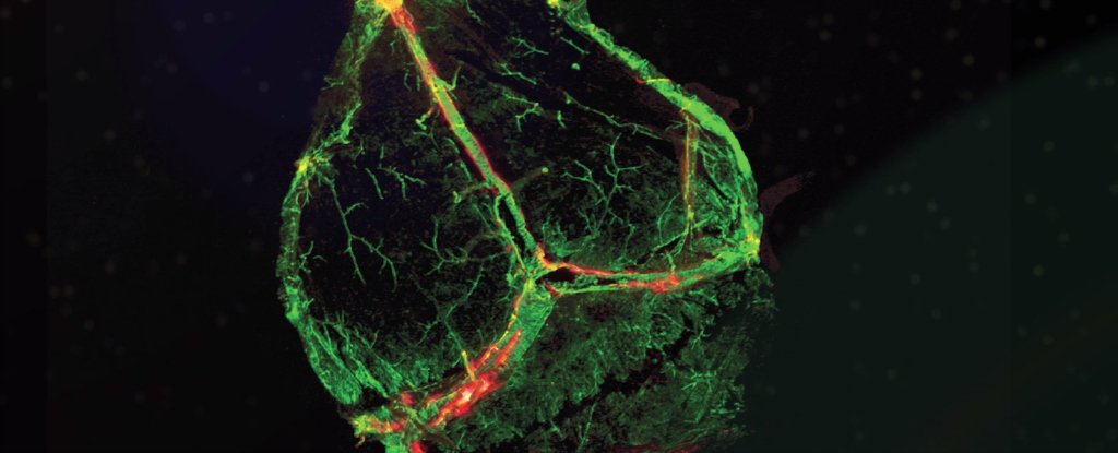 Discovery of the Brain’s Hidden Lymphatic Vessels Will Prompt a Rewrite of Textbooks