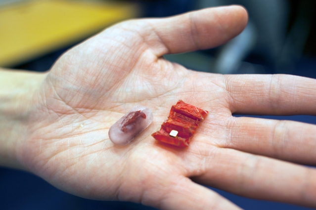 This Tiny Ingestible Robot ‘Can Patch Wounds, Remove Foreign Objects, and Deliver Drugs’