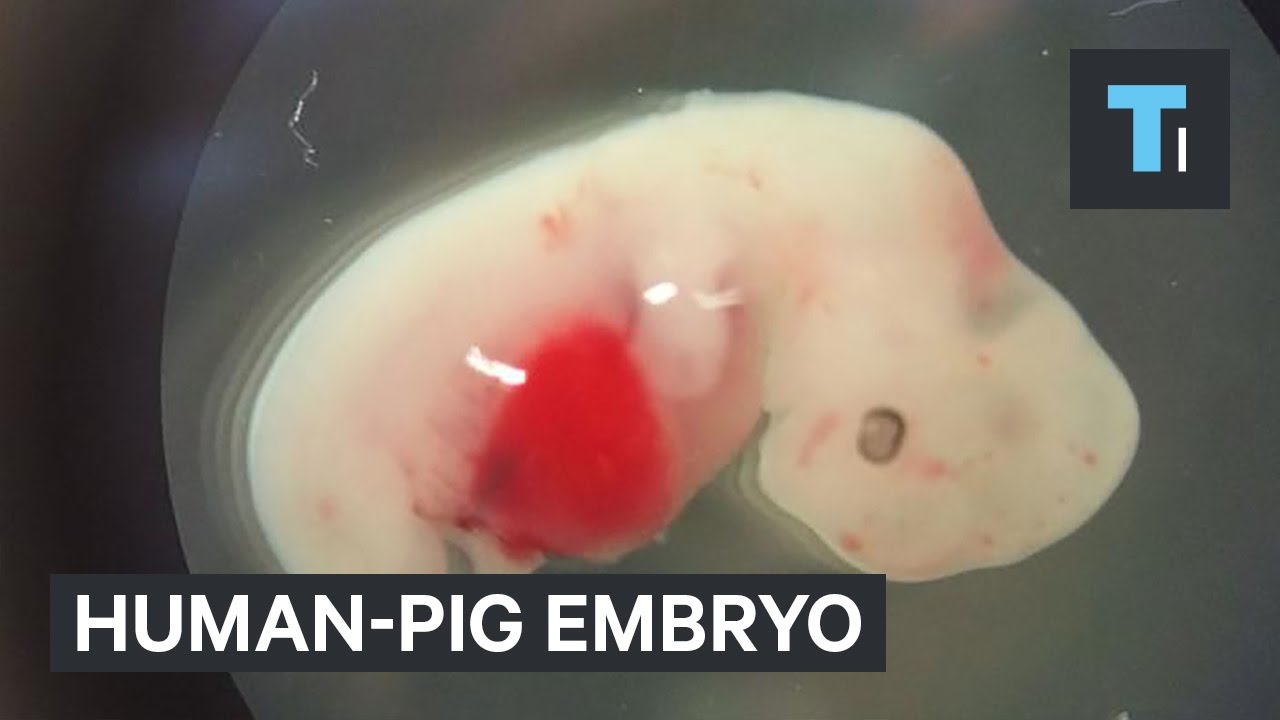 World’s First Human-Pig Hybrid Embryo Opens Possibility for ‘Designer’ Animal Organs for Human Use