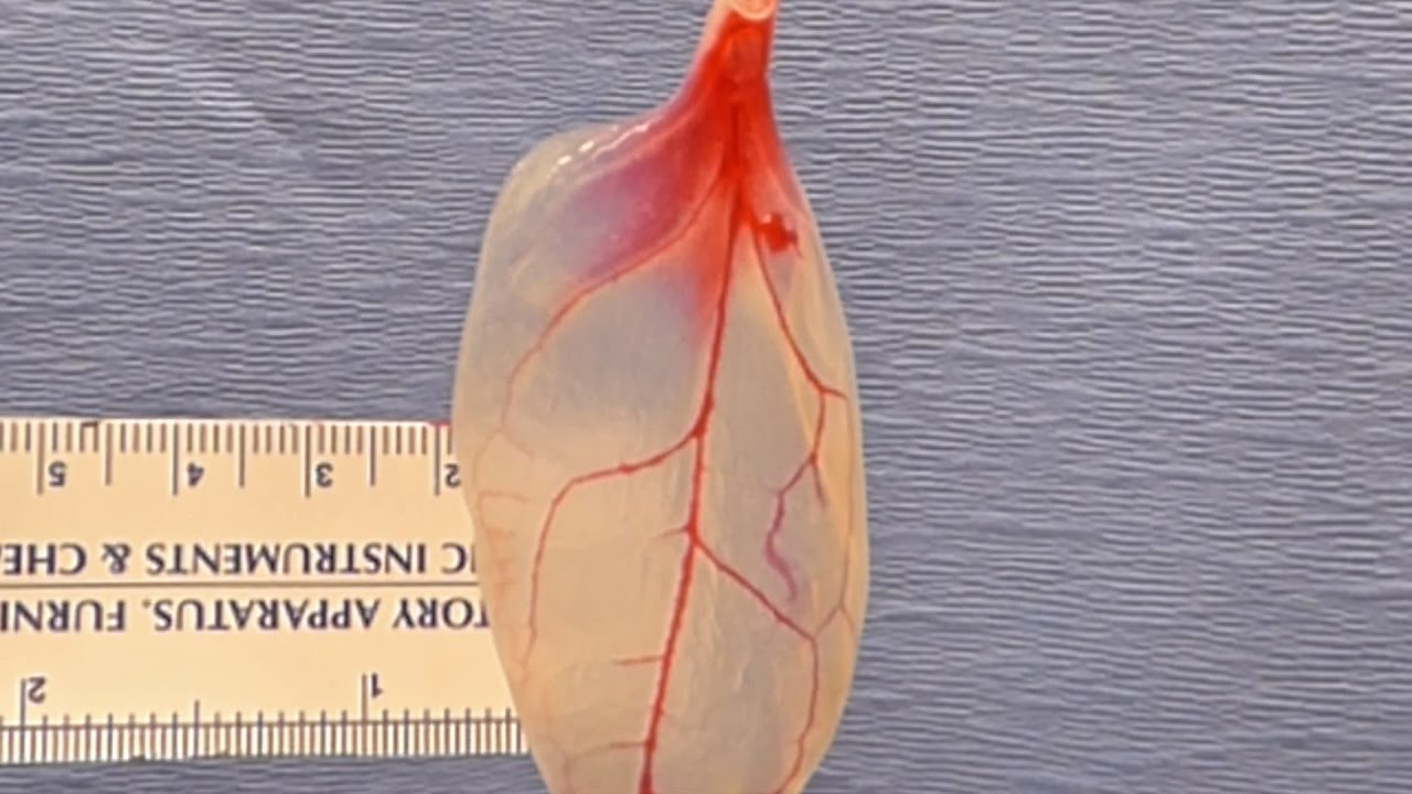 A New Hope for Organ Transplant Patients as Scientists Use Spinach Leaf to Grow Beating Human Heart Tissue
