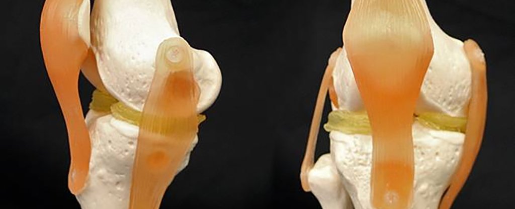 Cartilage-Like Hydrogel Could Make Knee Repairs Easier