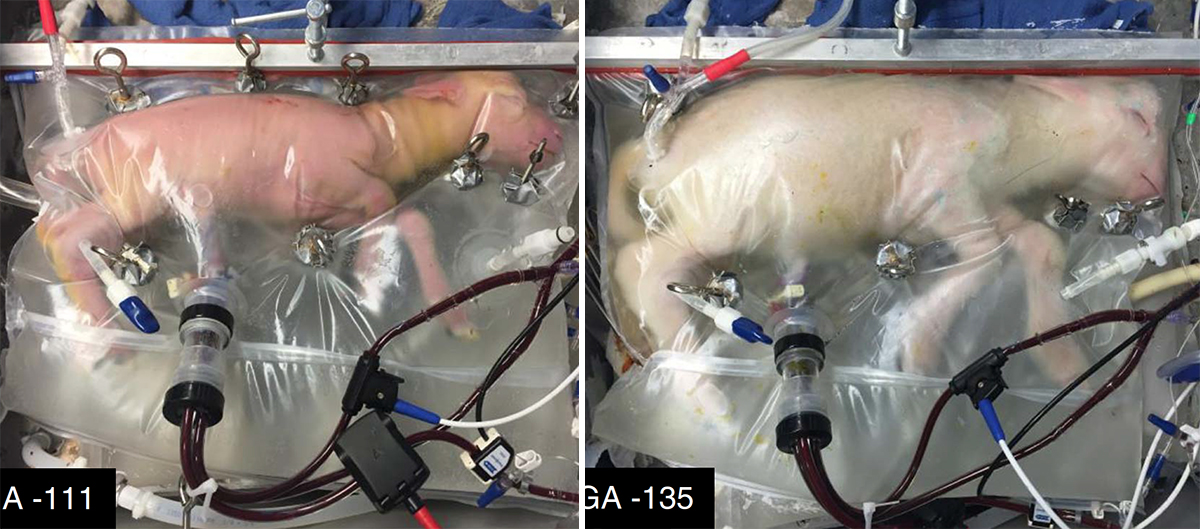 This Artificial Womb Helps Premature Lamb Fetuses Grow Outside the Womb, Might Be Used on Humans