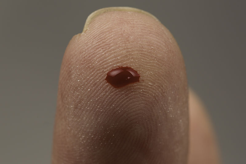 Microchip to Rapidly Monitor Stress Hormones from a Drop of Blood