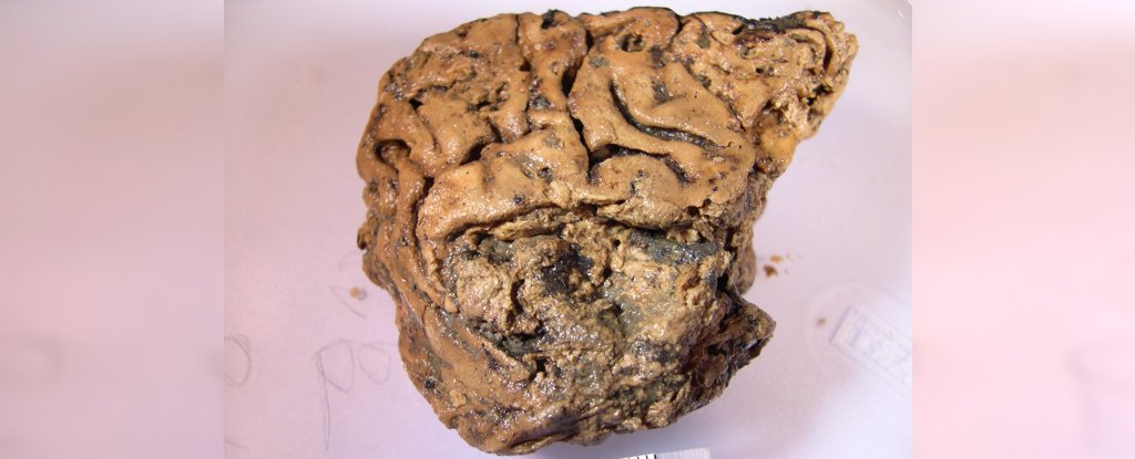 Scientists Finally Unravel the Mystery of 2,600-Year-Old Preserved Brain from UK
