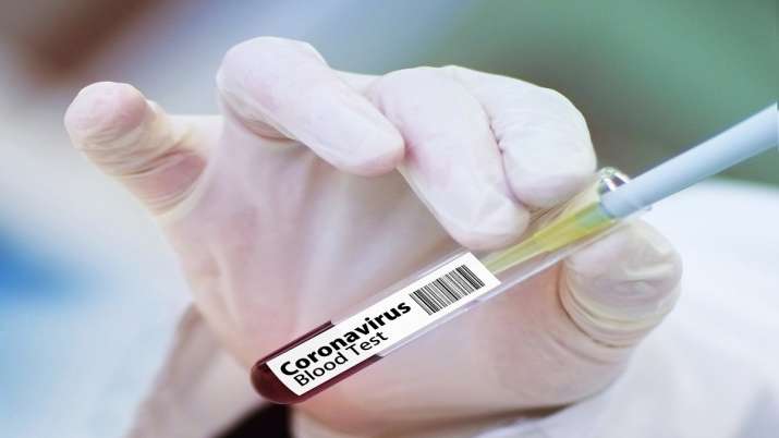 Russia Registers World’s First Coronavirus Vaccine, Putin’s Daughter Already Given a Shot