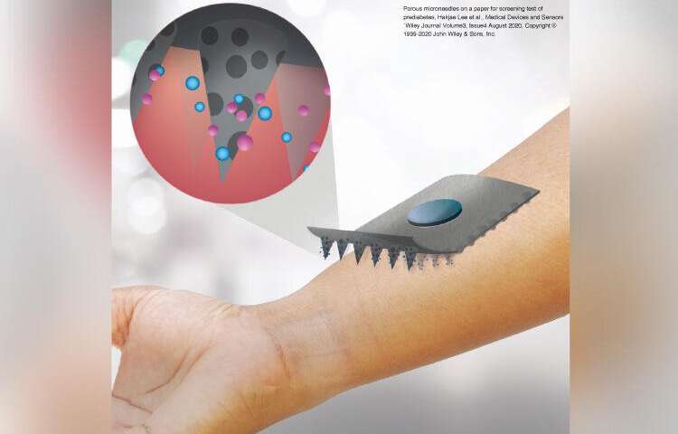 Painless Paper Microneedle Patch For Self-Monitoring Of Glucose Levels