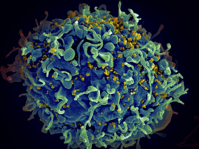 “Kick & Kill” – Cancer Drug to Kick and Wake up the Dormant HIV to Kill It