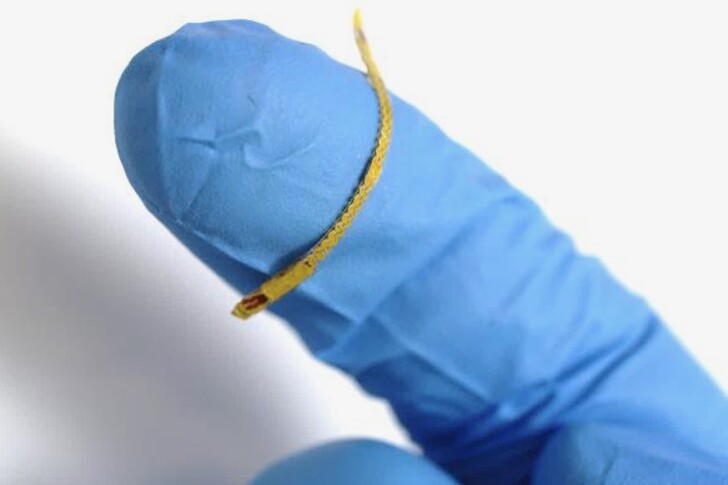Scientists Develop a Smart Artery Stent for Real-Time Monitoring Of Blood Flow Data