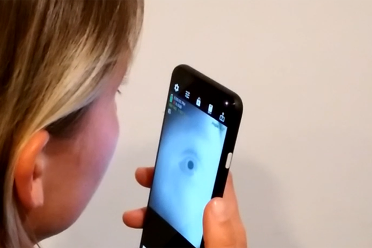 That’s truly Eye-Catching!  The Smartphone App Can Detect Early-Stage Alzheimer’s With a Selfie of Your EYE