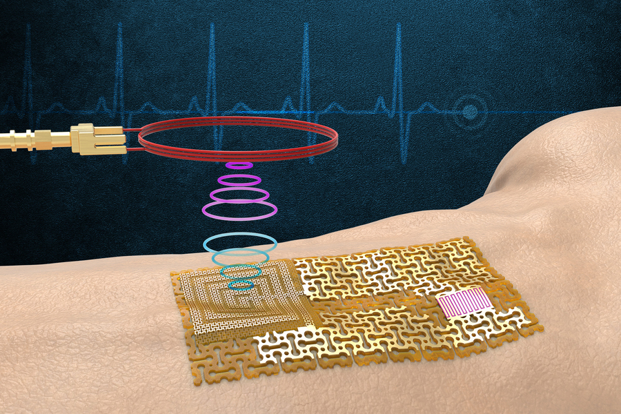 No Chips and Batteries – MIT Develops an Ultrathin Wireless E-Skin Sensor to Monitor Health