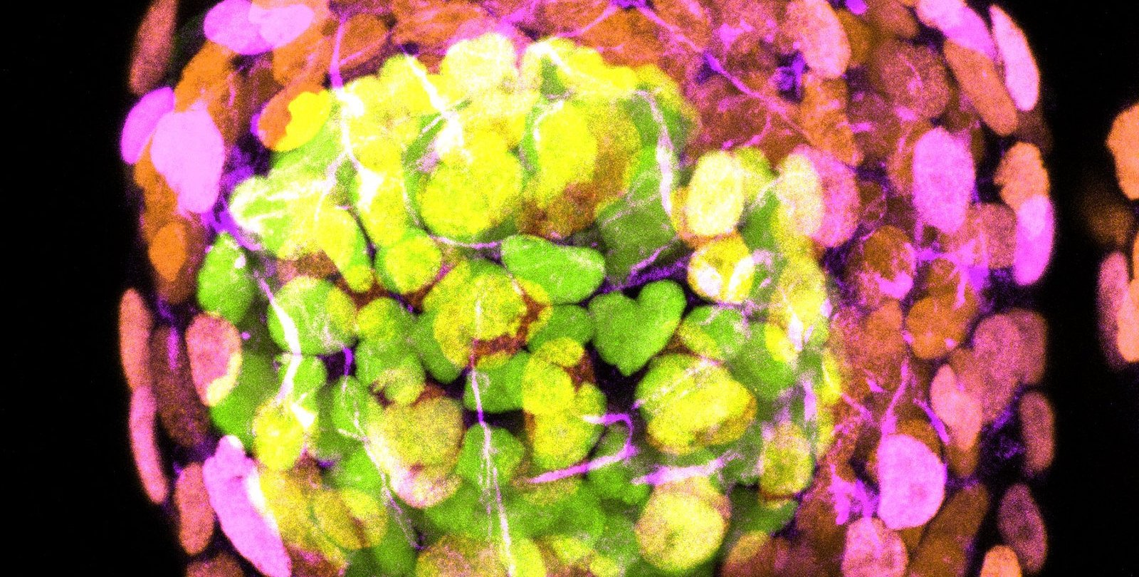 Unveiling Early Development Secrets: Scientists Engineer Human Embryo-Like Model