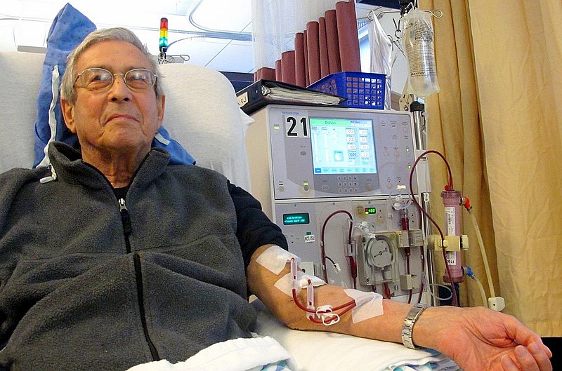 Exercise Reduces Hospital Visits for Dialysis Patients