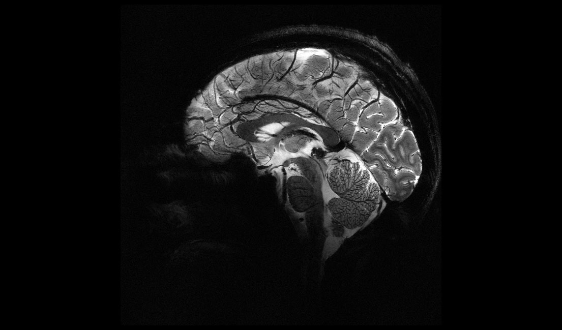 A Peek Inside the Living Mind: World’s Most Powerful MRI Unveils Unprecedented Brain Images
