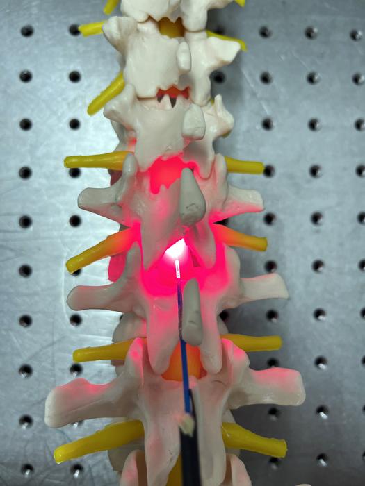 Illuminating Hope: Red Light Therapy Breakthrough in Spinal Cord Injury Treatment