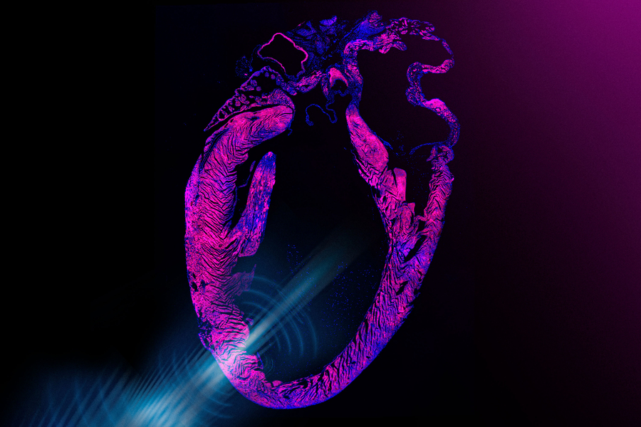 This Wearable Ultrasound Patch Could Make Heart Pacemaker Surgery Obsolete